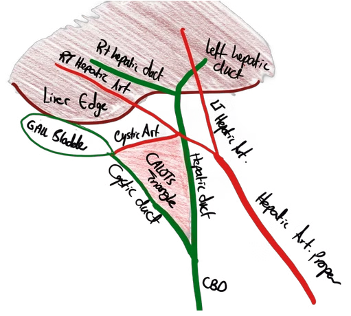 Angular cystic duct 70%