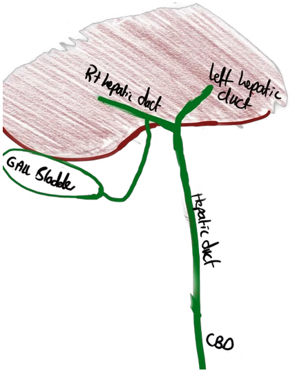 Cystic duct to right hepatic duct