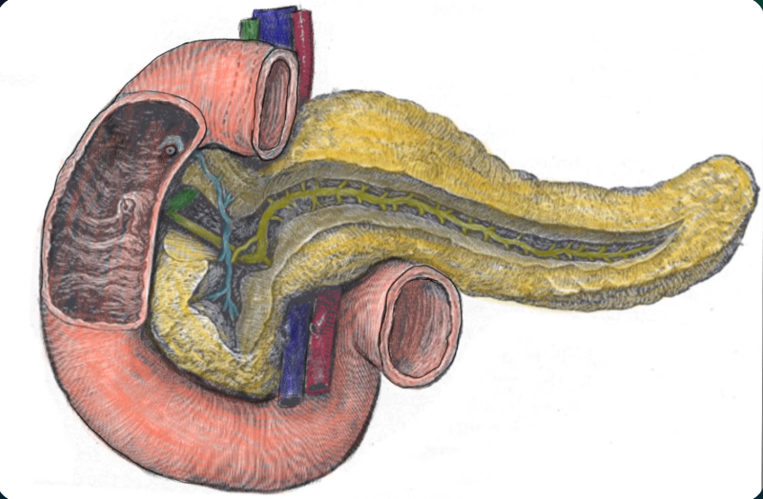 Pancreatic divisum overview