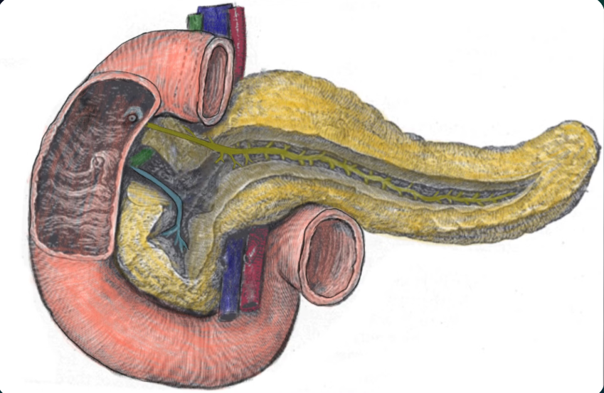 Type 1 pancreatic divisum