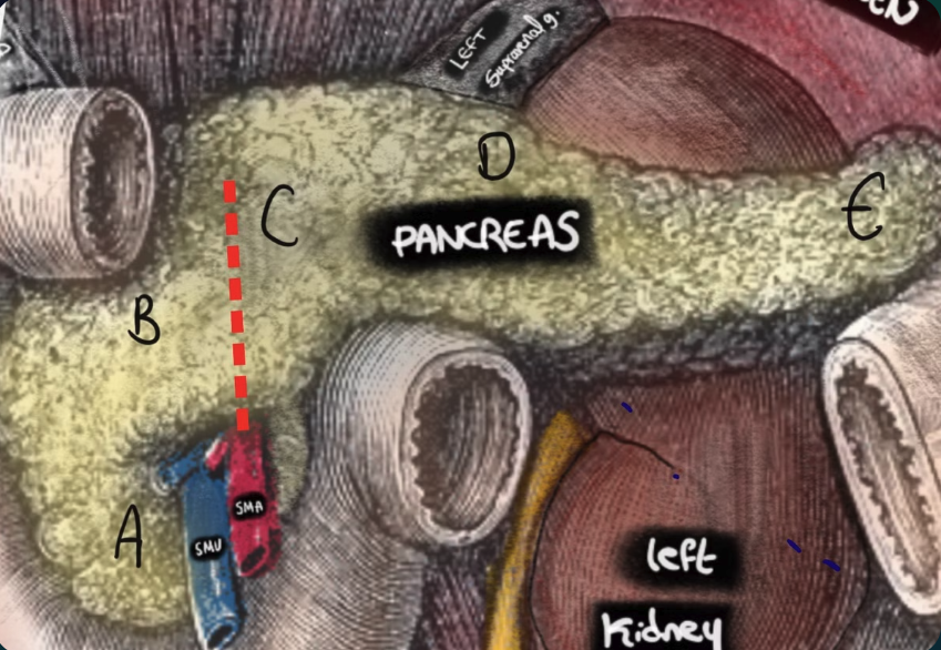 Route of the SMA around the pancreas