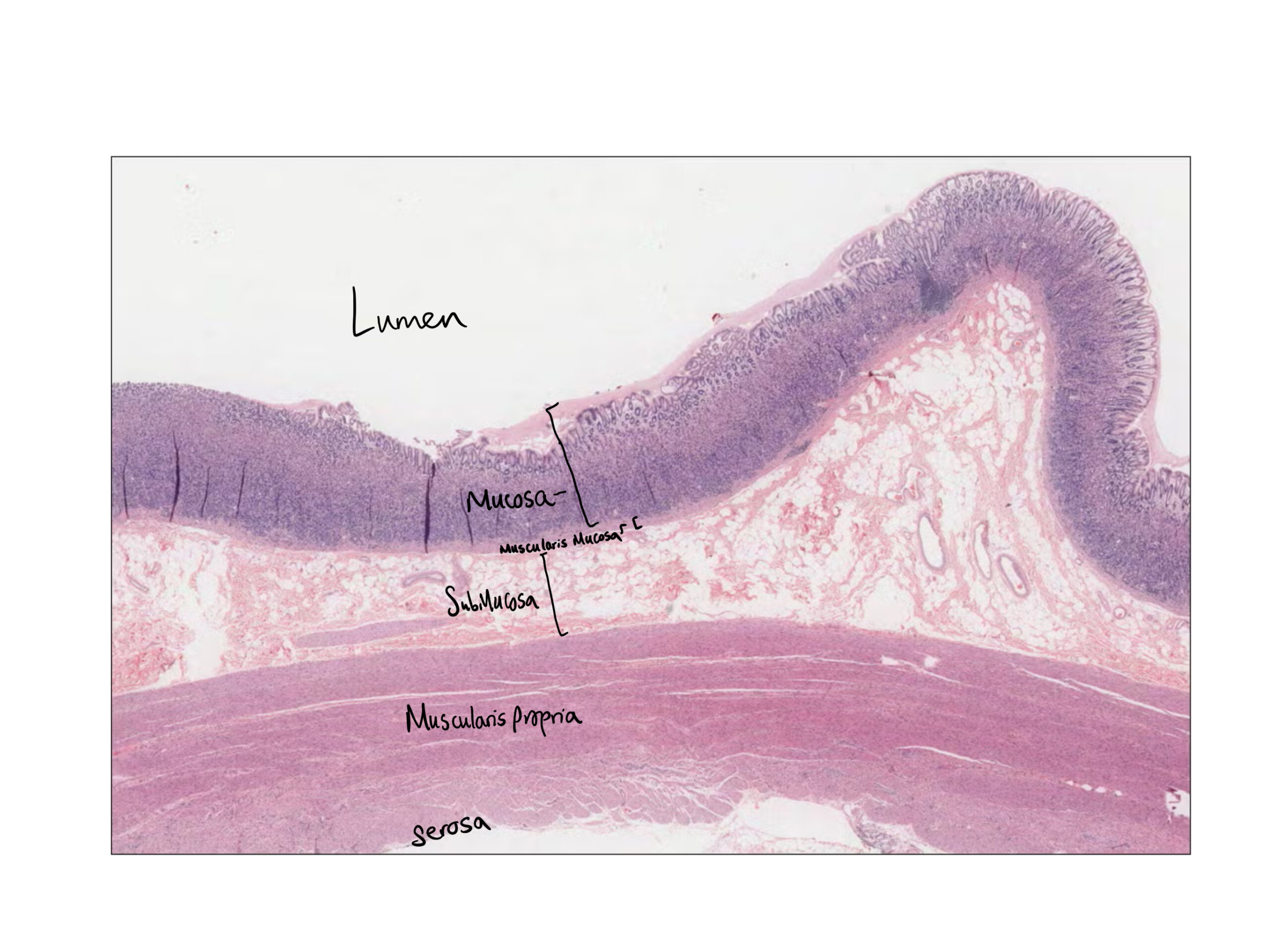 Gastric histology magnified