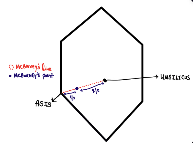 McBurney's Point diagram